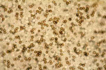 mushroom lamella micrography