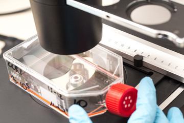 Flask with human cells at microscope