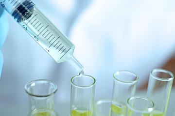 Doctor examining the urine in laboratory, closeup