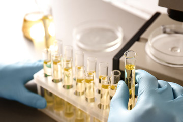 Doctor examining the urine in laboratory, closeup