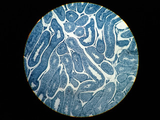 Cross section Human testis