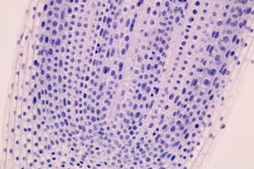 Root tip of Onion and Mitosis cell in the Root tip of Onion under a microscope.
