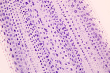 Root tip of Onion and Mitosis cell in the Root tip of Onion under a microscope.