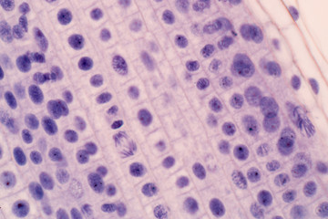 Root tip of Onion and Mitosis cell in the Root tip of Onion under a microscope.(soft focus)