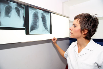 Hemodialysis, hemodiafiltration at ICU (intensive care unit), replacement of renal function, life...