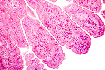 Villi of small intestine, light micrograph
