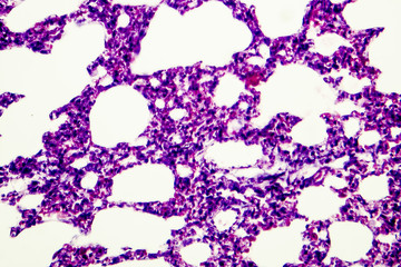 Microscopic photo showing lung tissue