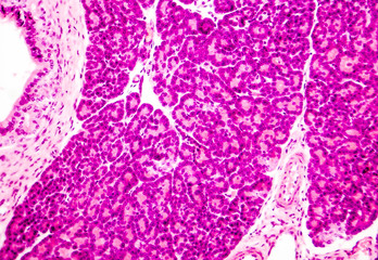 Microscopic photo showing pancreatic tissue