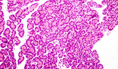 Microscopic photo showing pancreatic tissue