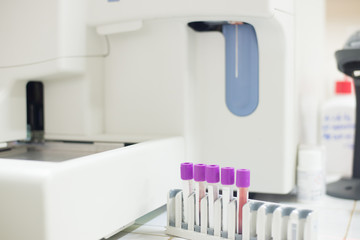 CBC Blood test tube in laboratory.