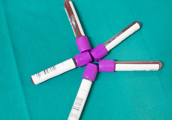 CBC Blood test tube in laboratory.