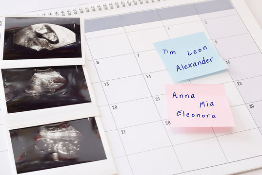 Ultraschalbilder von ungeborenes Baby und Sticker mit Namensvariationen auf Blatt des Kalenders