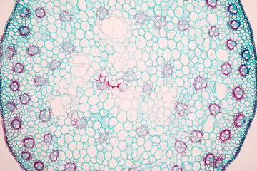 Stem typical Monocot and Dicot under a microscope.