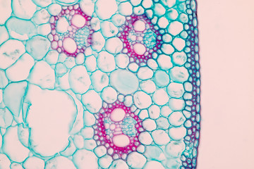 Stem typical Monocot and Dicot under a microscope.