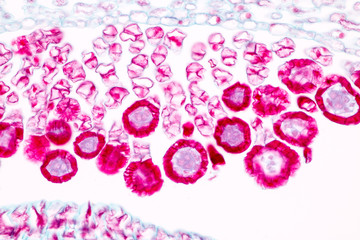 Indusium Fern under microscope view.