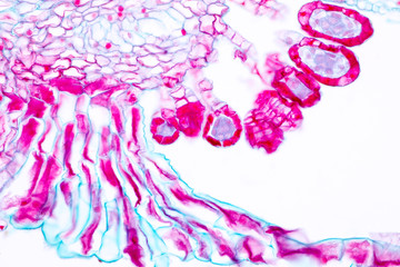 Indusium Fern under microscope view.