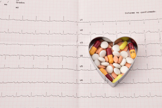 Control del coraz&oacute;n