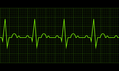 Heart beat. Cardiogram. Cardiac cycle