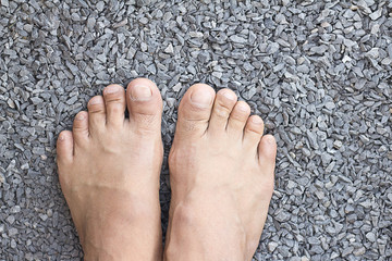 man bare feet in rocks
