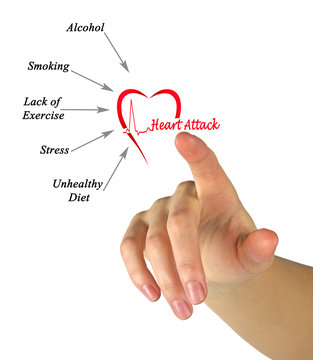 Causes of heart attack