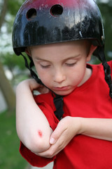 Scraped Arm