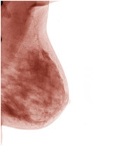 red image breast cancer xray on white background