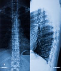Röntgenaufnahme eines menschlichen Körpers