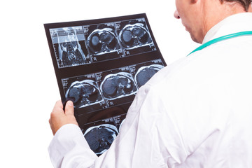 Doktor gegutachtet Röntgenbilder