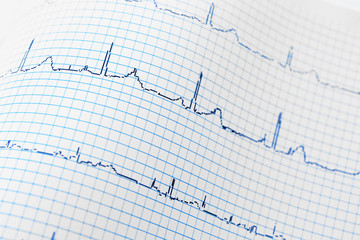 Electrocardiogram in paper form, closeup