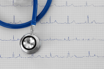 Electrocardiogram in paper form and stethoscope, closeup