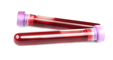 Test tubes with blood isolated on white