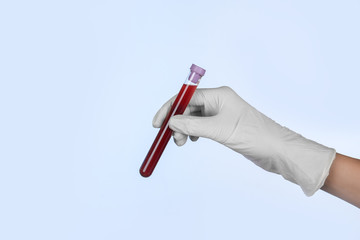 Hand of a doctor holding red blood in test tube on blue blurred background, close up