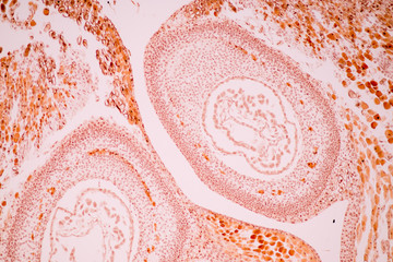 Pine cone and Pine Ovulate on the slide under microscope view.