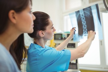 Female doctors examining x-ray