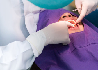 dentist wearing glove cleaning teeth with dental floss while patient open mouth