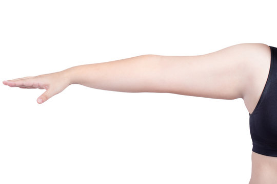 fat woman surgery mark arm cut body fat plastic surgery liposuction concept