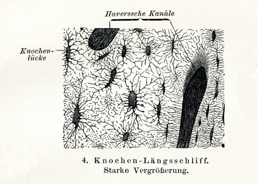 Longitudinal section of bone by high magnification (from Meyers Lexikon, 1895, 7/508/509)