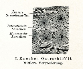 Cross-section of bone by medium magnification (from Meyers Lexikon, 1895, 7/508/509)