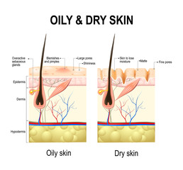 Oily and dry skin