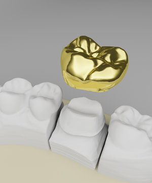 dental care