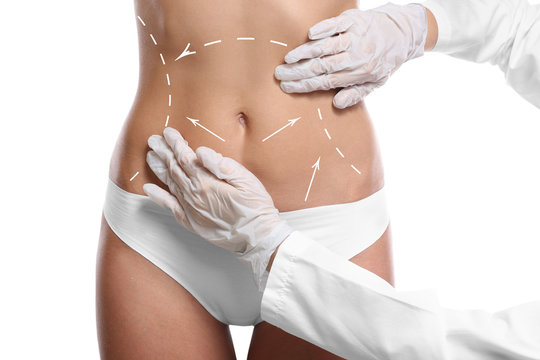 Surgeon examining female body before plastic operation, white background. Liposuction concept