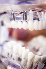 Dentists dental teeth model