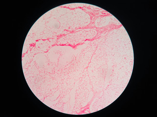 Human fat body tissue under microscope view