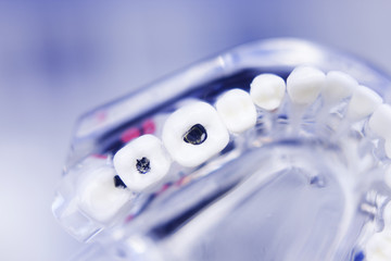 Dentists dental teeth model