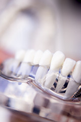 Fototapeta na wymiar Dentists dental teeth model