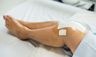Close up- Knee replacement surgery after operation patient on the bed in hospital