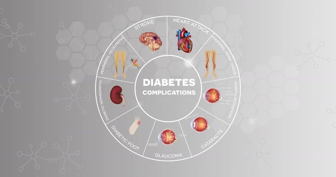 Diabetes mellitus affected organs info graphic, abstract grey scientific background. Diabetes affects nerves, kidneys, eyes, vessels, heart and skin.
