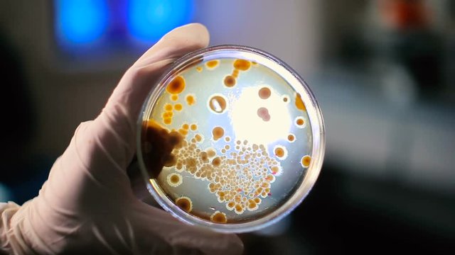 Make scraping colonies of bacteria.
