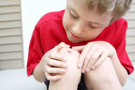 Boy with a scraped knee