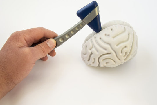 A neurologist, holding a neurological hammer, conducts examinations of the brain. The idea for the examination of the patient or a medical survey in the direction of neurology and internal medicine